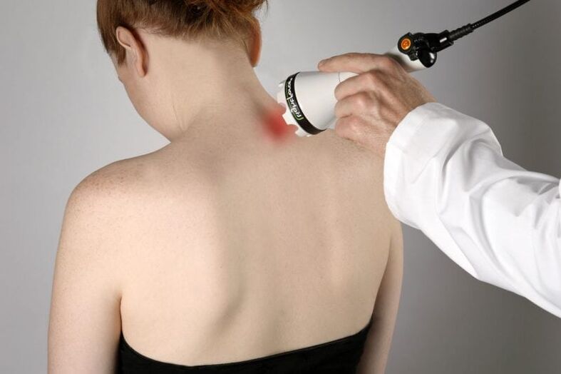 Moterų gimdos kaklelio osteochondrozės gydymas lazeriu